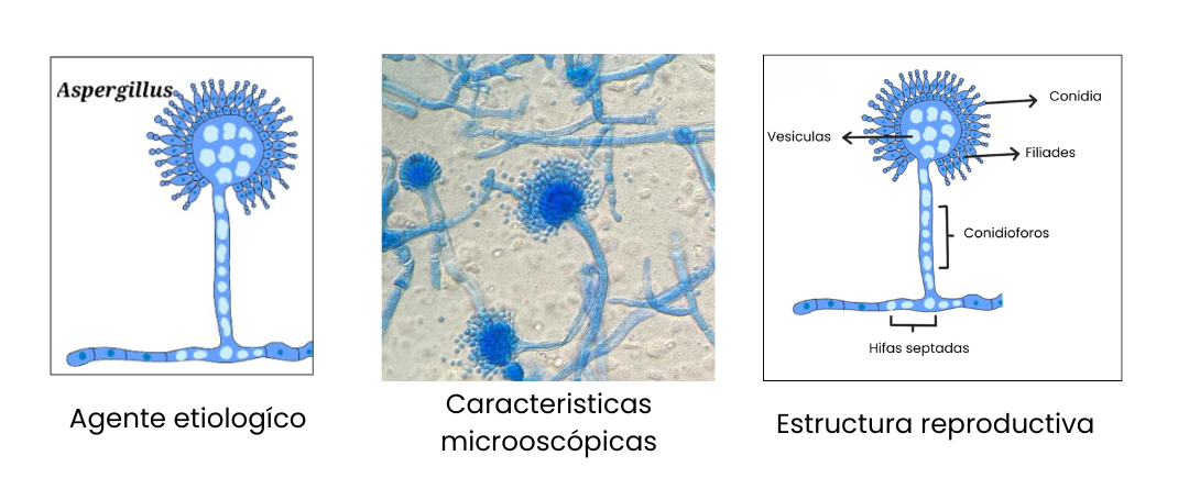 Ilustración de Aspergillus spp